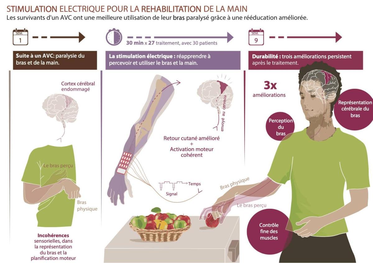 epfl-stimulation électrique neuromusculaire